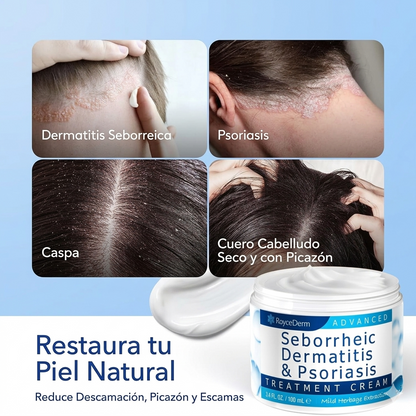 CREMA CALMANTE AVANZADA ROYCEDERM 🌿 — Alivia el enrojecimiento, la picazón y las escamas con extracto herbal suave